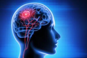 Obat Antidepresi Berpotensi Atasi Tumor Otak: Terobosan Baru dalam Pengobatan Kanker
